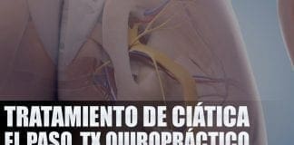 Tratamiento de Ciática El Paso, TX Quiropráctico