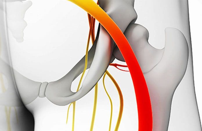 sciatica-nerve-pain-el-paso-tx
