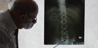Infections of The Spine: Symptoms, Risks, Diagnosis
