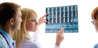 Compression Fracture