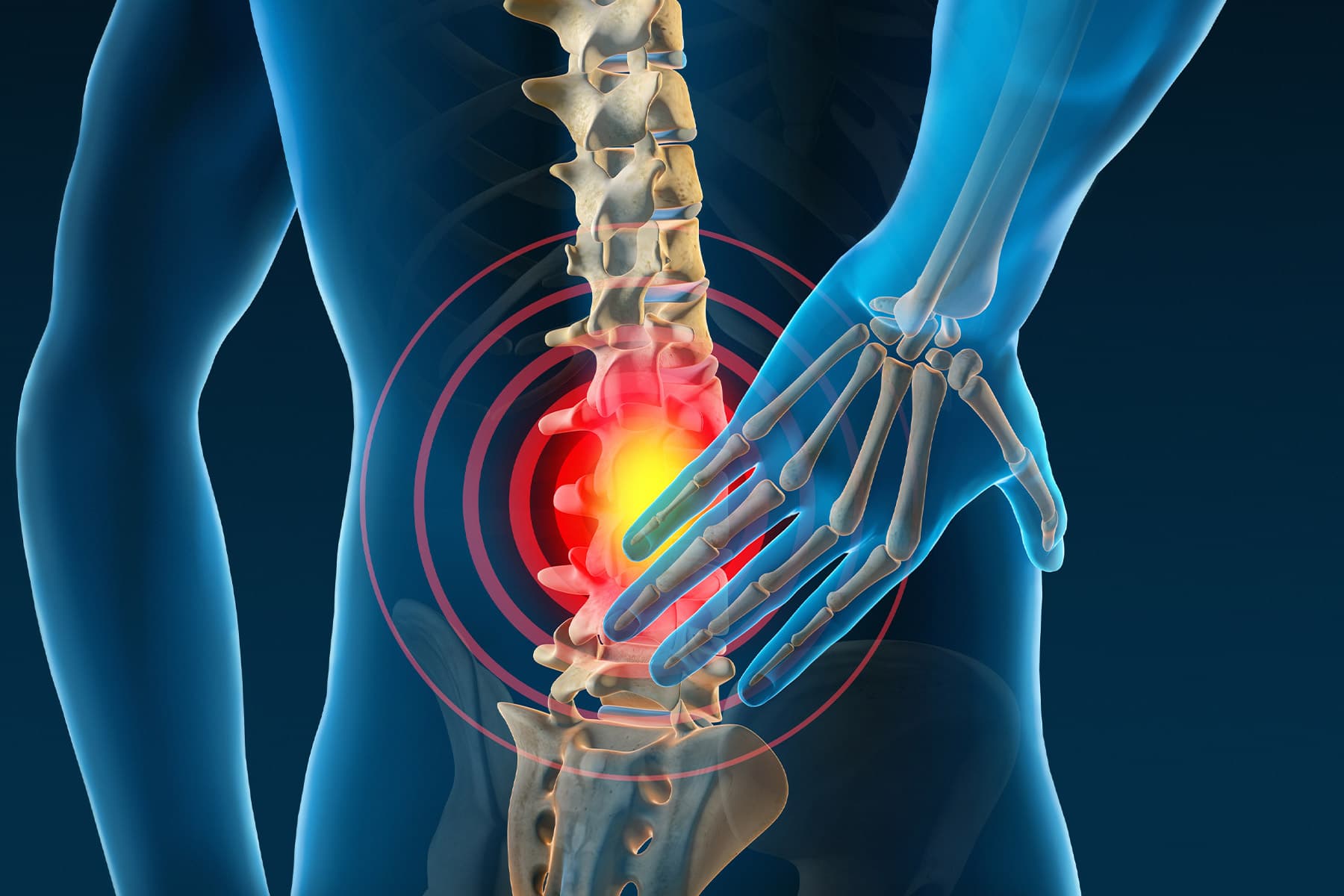 Is Lower Back Pain Associated With Gallstones