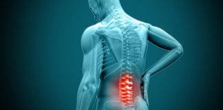 Non-Surgical Spinal Decompression For Chronic Low Back Pain