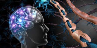 The Impact Of Multiple Sclerosis On The Body