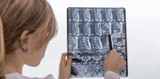 Diarrhea and Low Back Pain: Chiropractic Medical Care