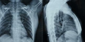 Internal Organ Damage Chiropractic Sciatica Clinic