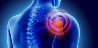 Shoulder Joint Pain Associated With Trigger Points