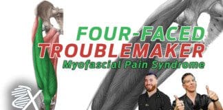 Myofascial Pain Syndrome Affecting The Quadriceps Femoris