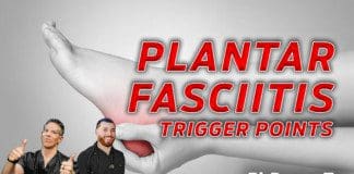 Plantar Fasciitis & Trigger Points On The Feet