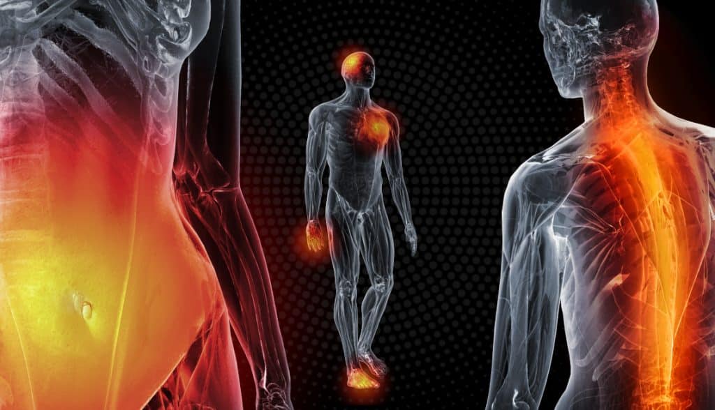Food Allergies Inflammation And Met Therapy El Paso Tx Sciatica 