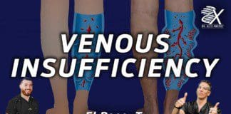 Venous Insufficiency: What you need to know | El Paso, Tx (2023)