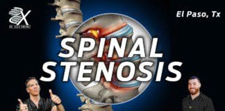 The Root Causes of Spinal Stenosis | El Paso, Tx (2023)