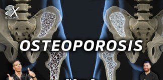 Osteoporosis *MUST WATCH* | El Paso, Tx (2023)