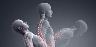 Facet Syndrome Protocols For Spinal Decompression