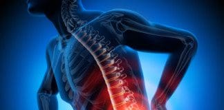 Intervertebral Disc Stress Relieved By Decompression