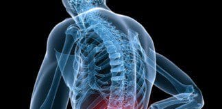 A Cost-Effective Treatment For Lumbosacral Pain