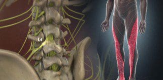 Incorporating Spinal Decompression Treatments For Lumbosacral Pain