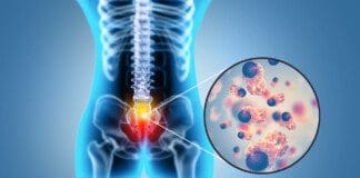 Tackling Lumbar Degenerative Disorders with the Right Treatment