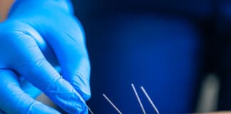 Acupuncture for Arthritis: Can It Help Manage Symptoms?