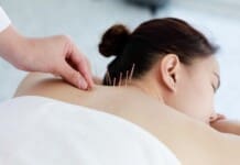 Say Bye to Fibromyalgia Pain with Acupuncture