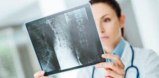 The Effects of Spinal Decompression Therapy: An Ultimate Guide