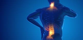 What You Need to Know About Degenerative Pain Syndrome Relief