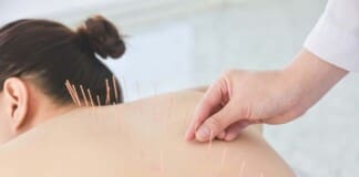 Overcoming Low Back Pain with Acupuncture: Expert Advice
