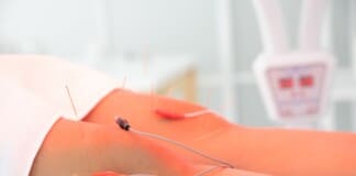 Acupuncture-Electroacupuncture: A Holistic Approach to Healing