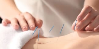 Acupuncture for Gut Health: The Benefits Explained