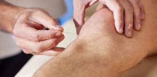The Effectiveness of Acupuncture for Knee Pain Relief