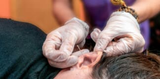 Acupuncture for Weight Loss: An Overview