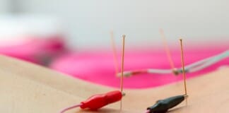 Elevate Your Musculoskeletal Health with Electroacupuncture