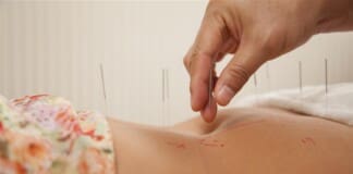 How Acupuncture Can Help Reduce Joint Pain in Lupus