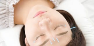 The Role of Acupuncture in Improving Eye Health