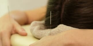 Relieve Eczema Symptoms with Acupuncture