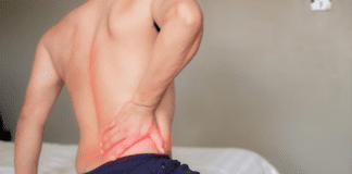 Non-Surgical Treatments for Sciatica Pain Management