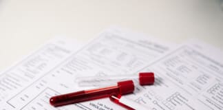 Using Blood Tests to Determine the Underlying Cause of Back Pain