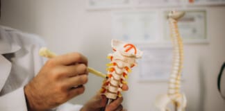 Managing Nerve Root Encroachment with Surgical Decompression