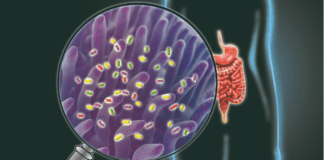 The Best Natural Probiotic Foods for a Healthy Gut and Strong Immunity