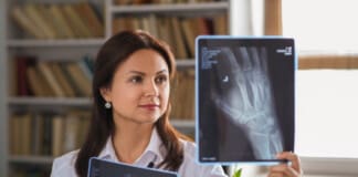 Scaphoid Fracture: Causes, Symptoms, and Treatments