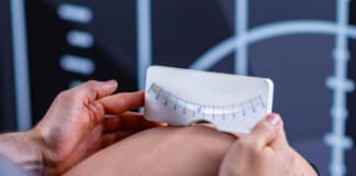 Cobb Angle: Key Indicator for Spine Health