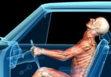Whiplash and Achilles Tendinosis: Auto Accidents Explained