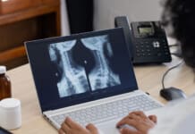 Enhanced Surgical Recovery for Spine Surgery Insights Enhanced Surgical Recovery for Spine Surgery Insights