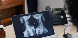 Enhanced Surgical Recovery for Spine Surgery Insights Enhanced Surgical Recovery for Spine Surgery Insights