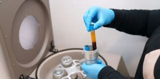 Platelet-Rich Plasma in Musculoskeletal Care Protocols Platelet-Rich Plasma in Musculoskeletal Care Protocols