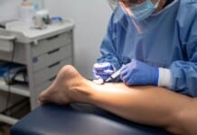 PRP Therapy Results on Plantar Fasciitis on the Achilles Tendon