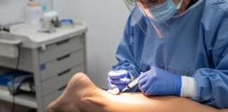 PRP Therapy Results on Plantar Fasciitis on the Achilles Tendon
