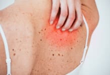 Functional Medicine Benefits for Skin Health & Inflammation