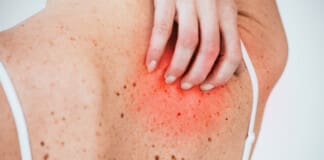 Functional Medicine Benefits for Skin Health & Inflammation