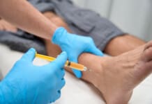 Chronic Tendinopathy Solutions With Regenerative Orthopedics