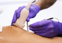 Percutaneous Tenotomy for Chronic Tendinopathy Approaches Percutaneous Tenotomy for Chronic Tendinopathy Approaches